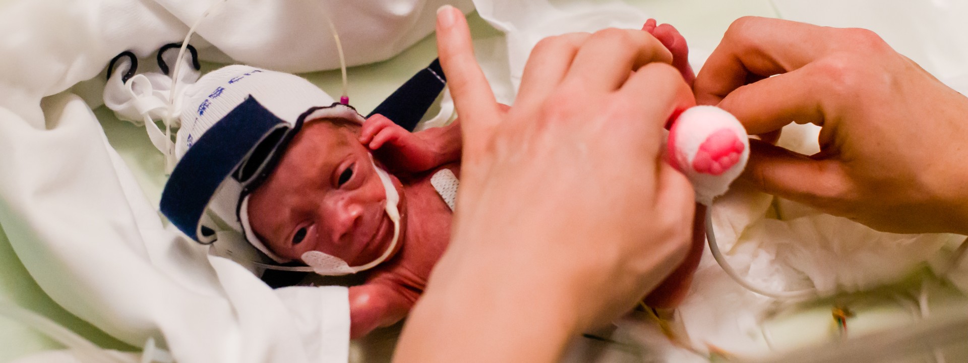 photo of micropreemie