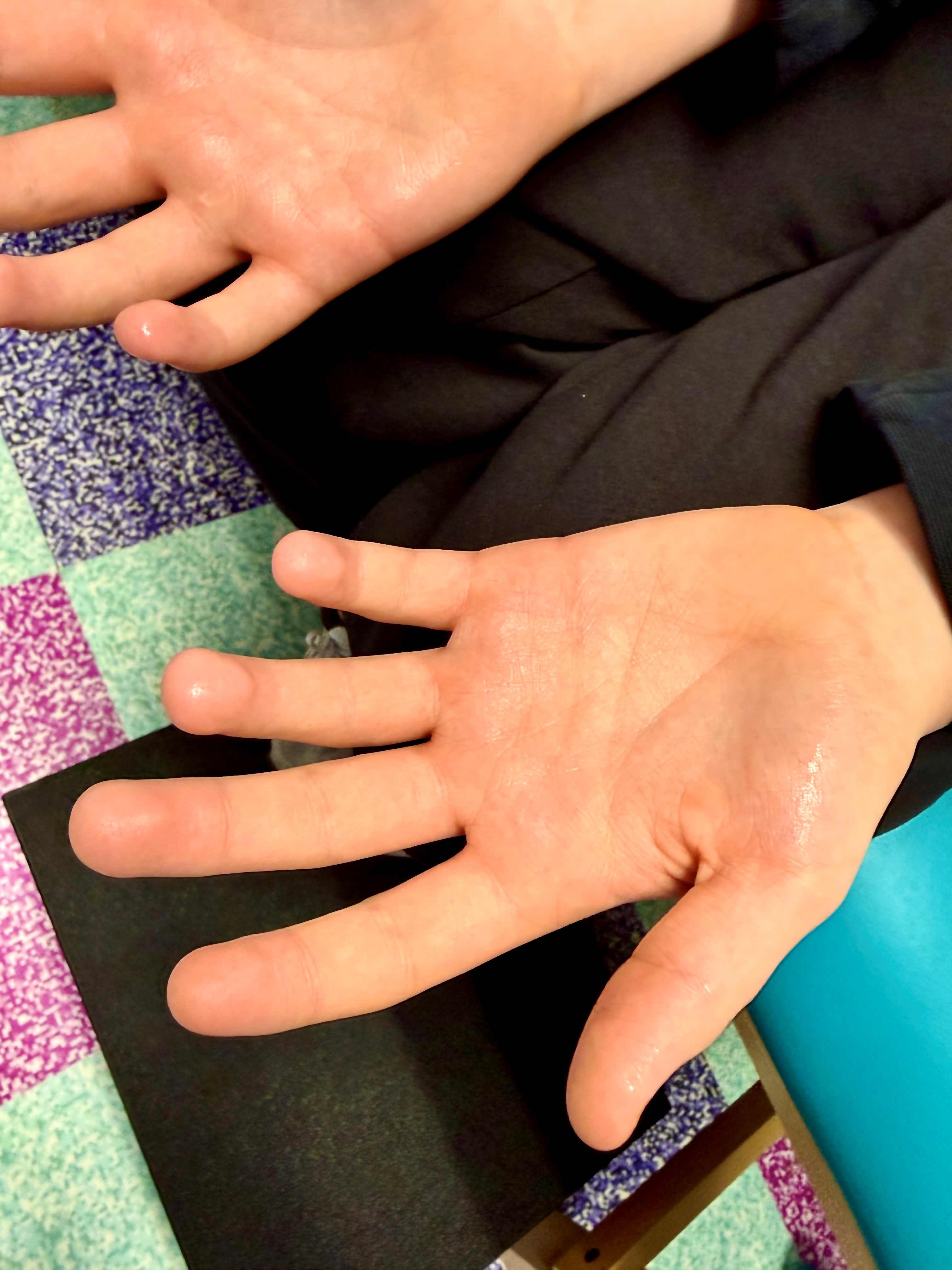Two open hands, palms up, visibly wet with sweat. Dark clothing and a colorful patterned surface in the background