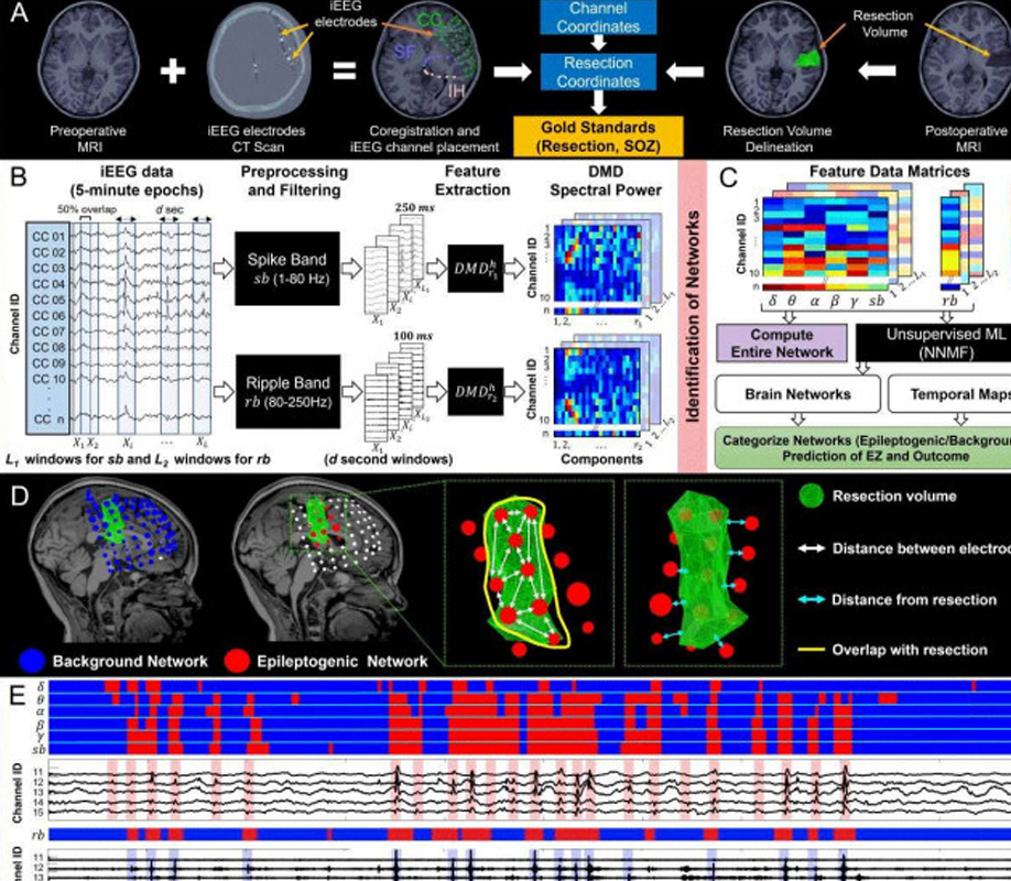 Diagram: iEEG data analysis workflow to identify epileptogenic brain networks and predict epilepsy surgery outcome