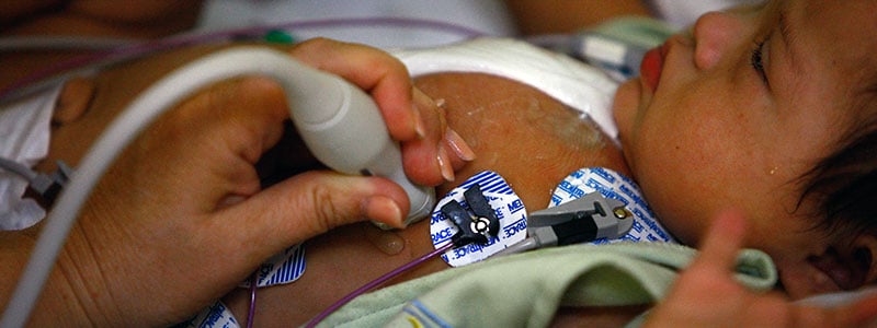 photo-fetal-echo