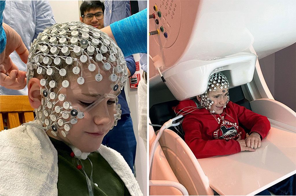 HD-EEG-fig1