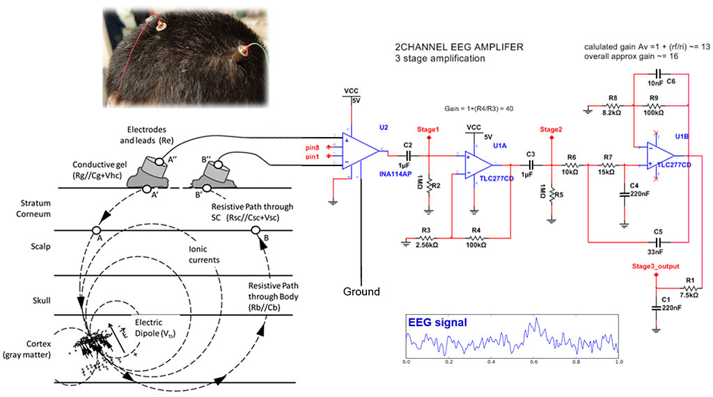 HD-EEG-fig5