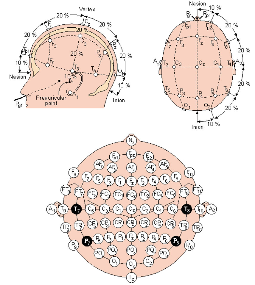 HD-EEG-fig6