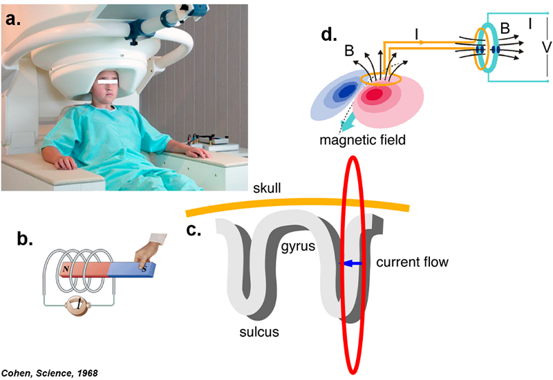meg-fig-1