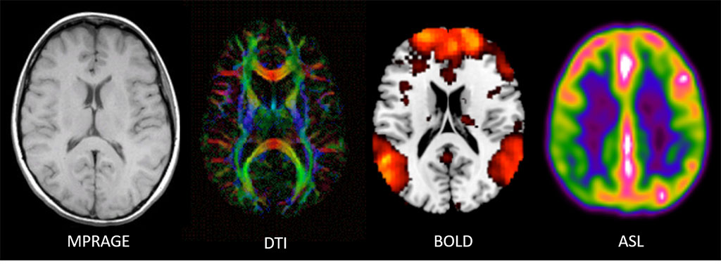 MRI-Figure-3---MRI