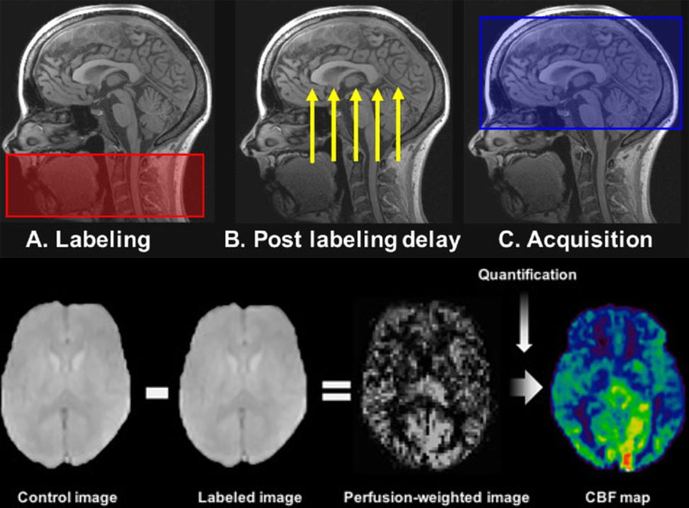 MRI-Figure-4---MRI