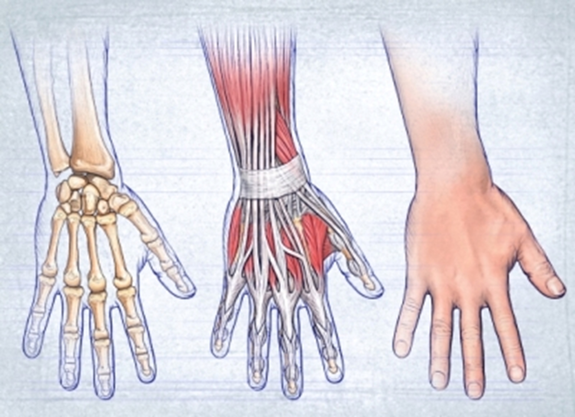 mallet-finger-main