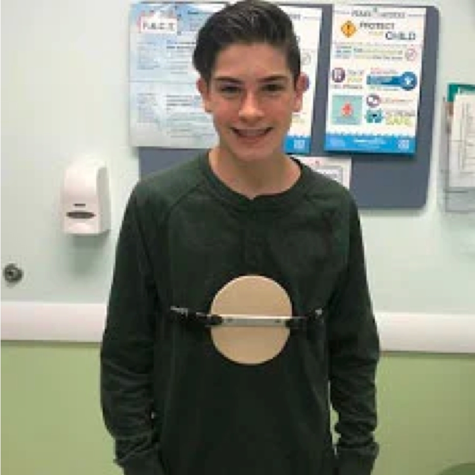pectus_quote_img_ben.jpg