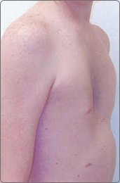 photo-exc-male-1