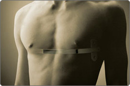 photo-pectus2